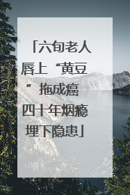 六旬老人唇上“黄豆”拖成癌 四十年烟瘾埋下隐患